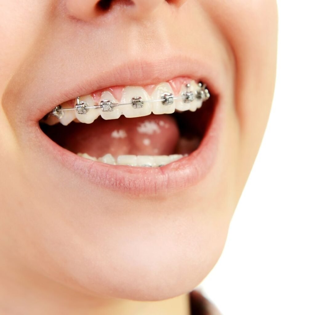 Tollgate Orthodontics