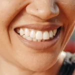 What You Need to Know About the Truth Behind the Cost of Dental Teeth Whitening