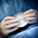 The Pros and Cons of Large Breast Implants