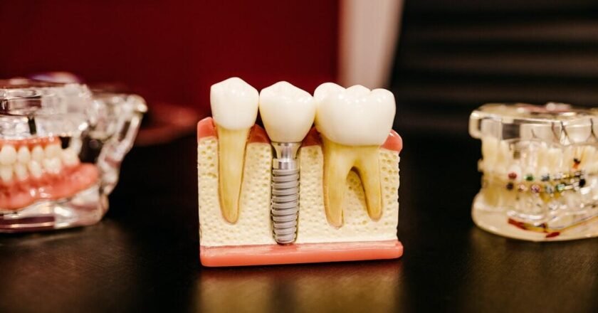 The Ultimate Guide to Finding the Most Affordable Dental Implants