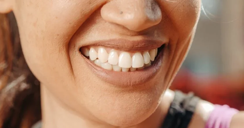 Achieve a Brighter Smile: The Benefits of Professional Dental Whitening